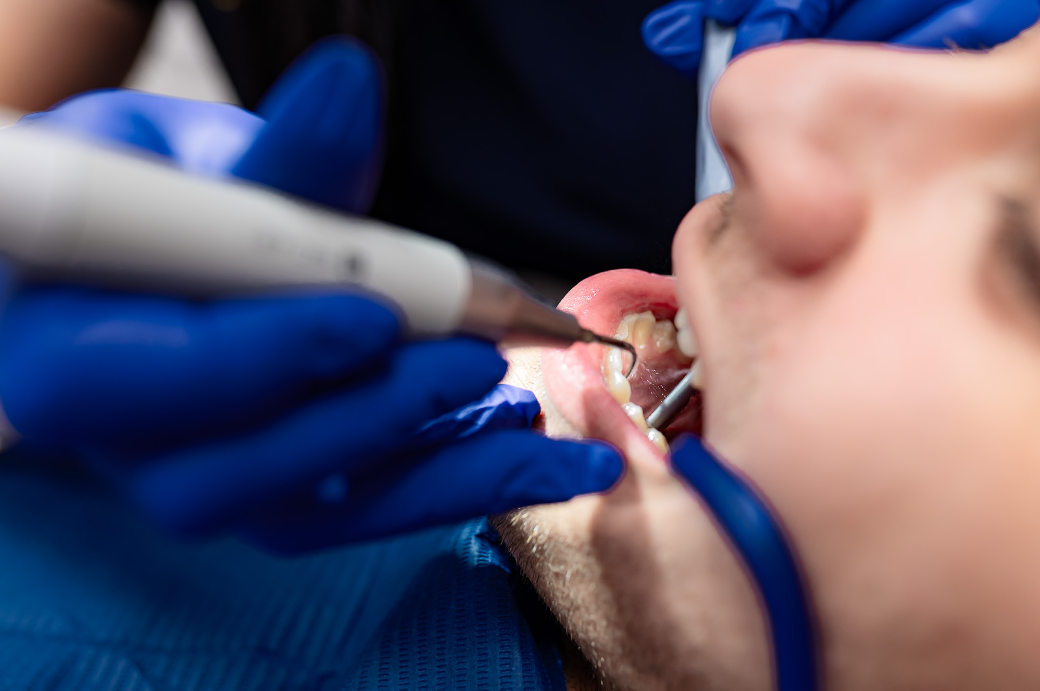 Dlaczego regularna higienizacja jamy ustnej jest tak ważna?