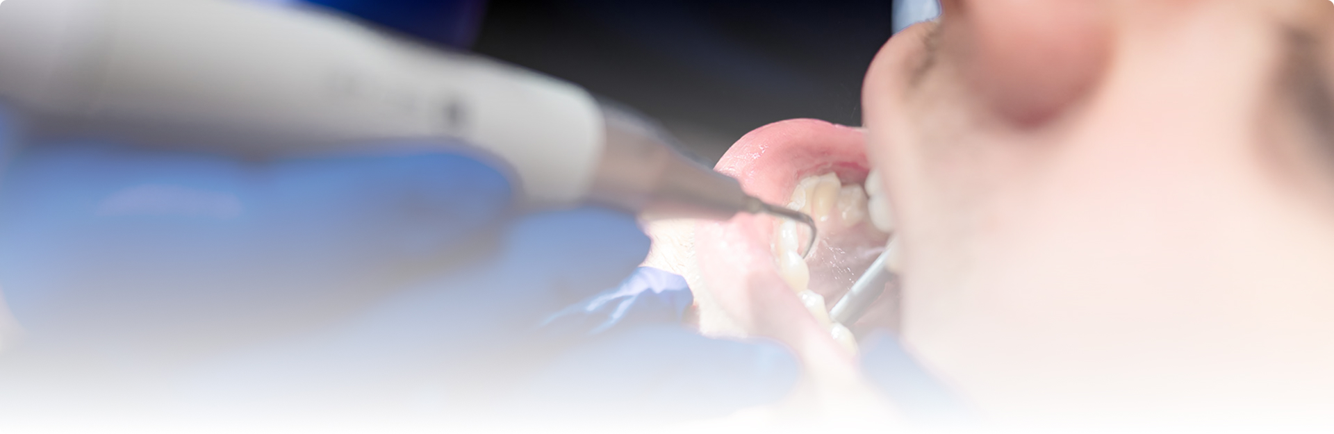 Skaling, piaskowanie, fluoryzacja